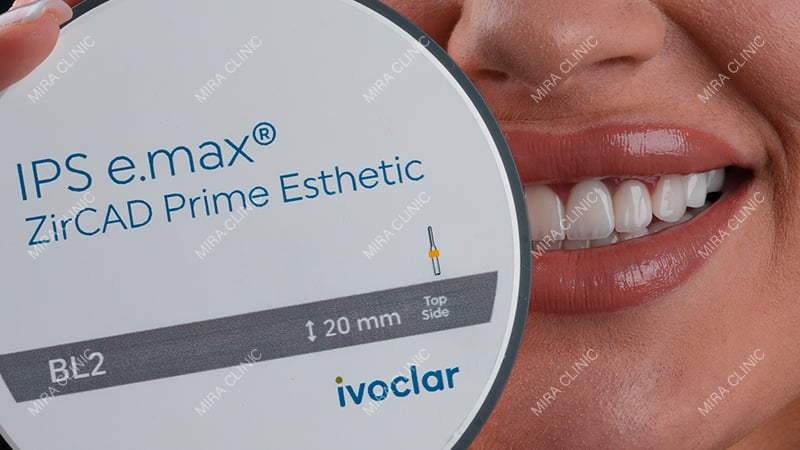 E-max Crown